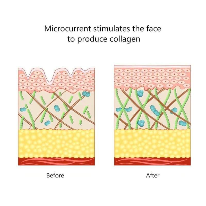 Electric Face Messager - Beauty Product