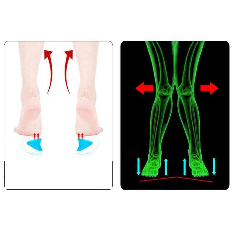 Flat foot insoles Just For You - Foot Care Tool