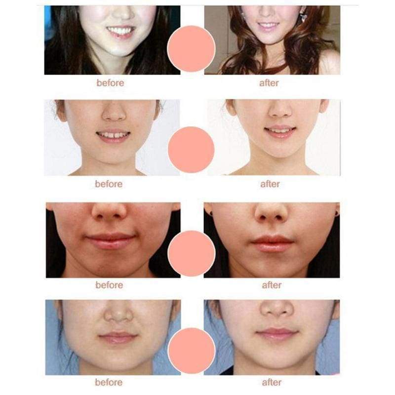 V Shape Lifting Facial Mask Face Slim - Face Skin Care Tools
