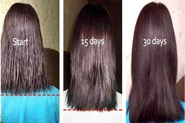 Image result for women hair growth before and after